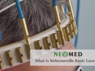 Weberneedle therapy