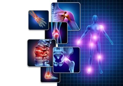 Fibromyalgia