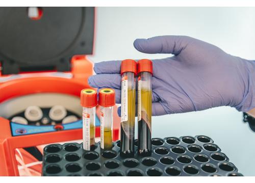 Activated PRP