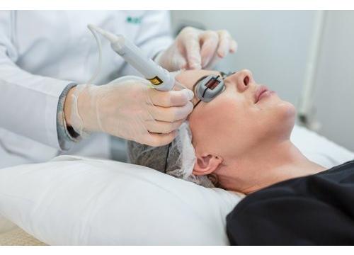 Laser Biorevitalisation