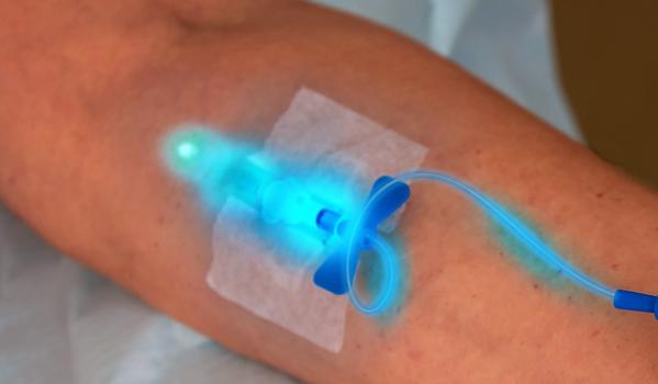 Intravenous Laser Therapy