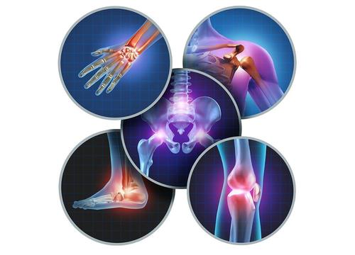 Rheumatoid arthritis
