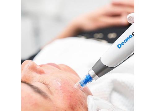Dermapen with Serum and Celluma LED