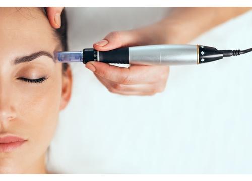 Microneedling