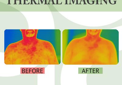 Thermal Imaging