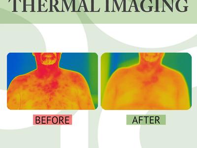 Thermal Imaging