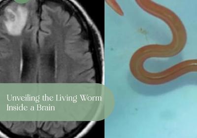 Unveiling the Living Worm Inside a Brain