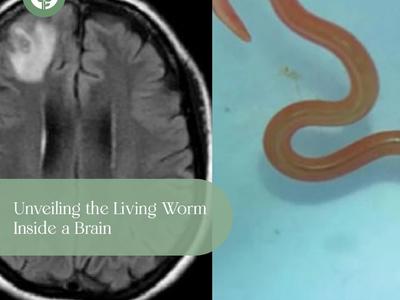 Unveiling the Living Worm Inside a Brain