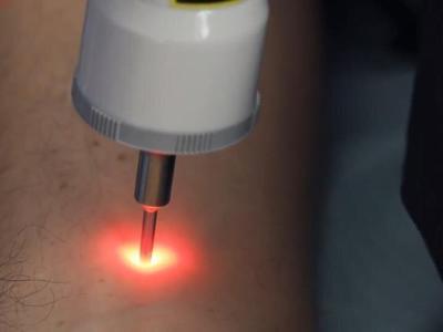 Low-Level Laser Therapy