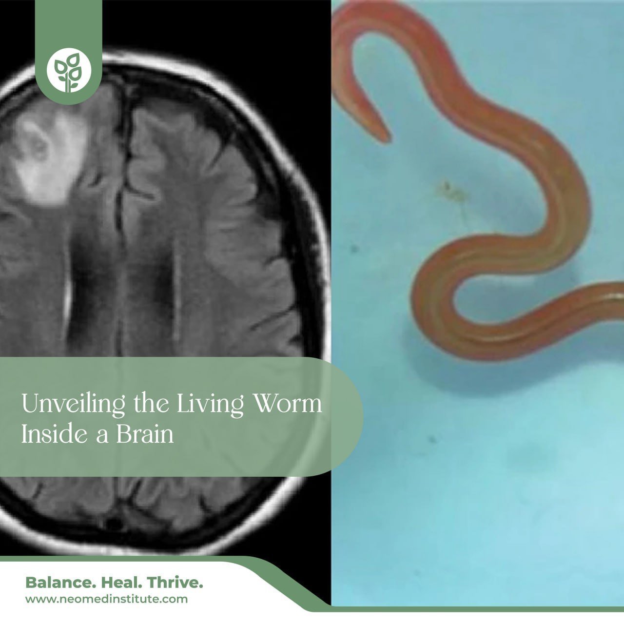 Unveiling the Living Worm Inside a Brain