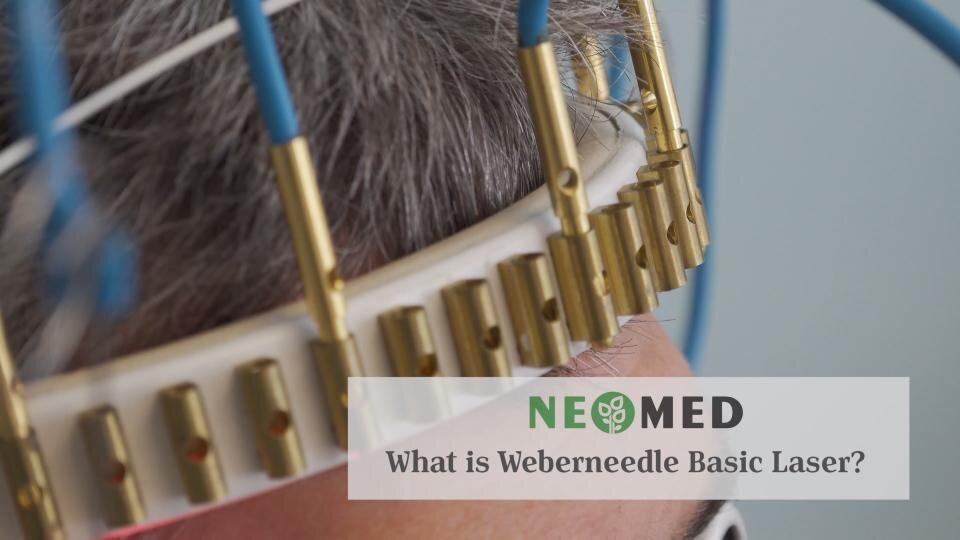 Weberneedle therapy