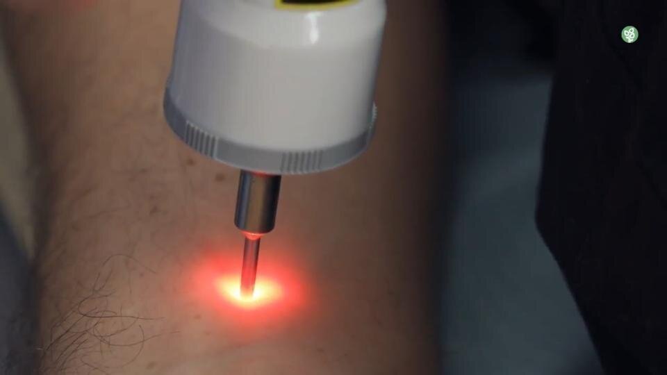 Low-Level Laser Therapy