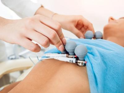 Electrocardiogram